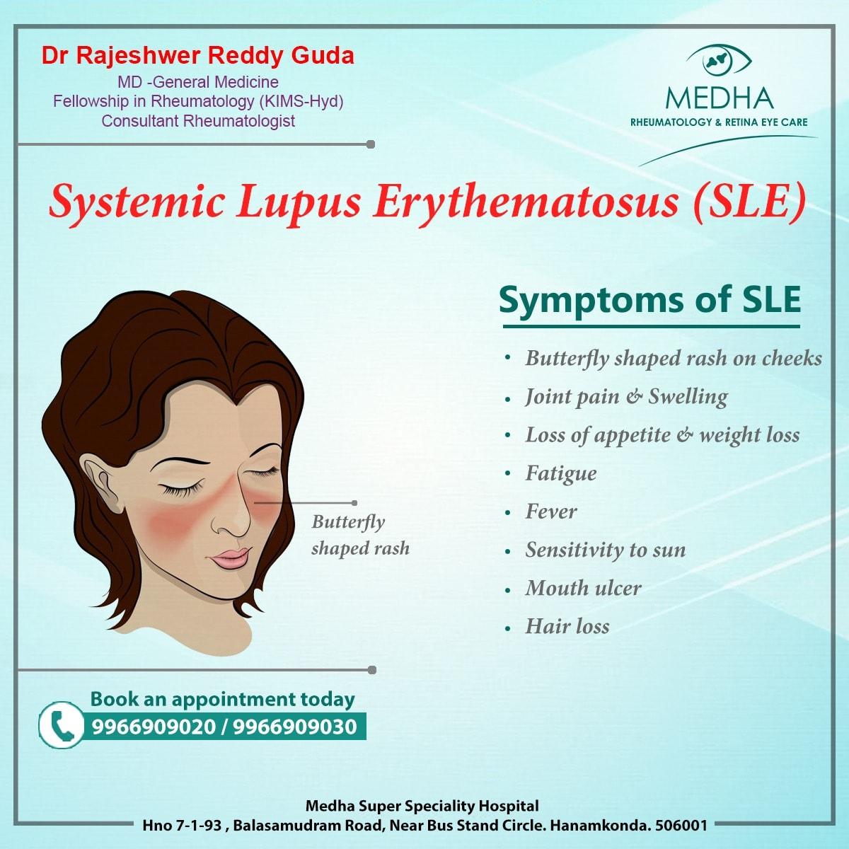 SLE is a chronic disease that can have phases of worsening symptoms