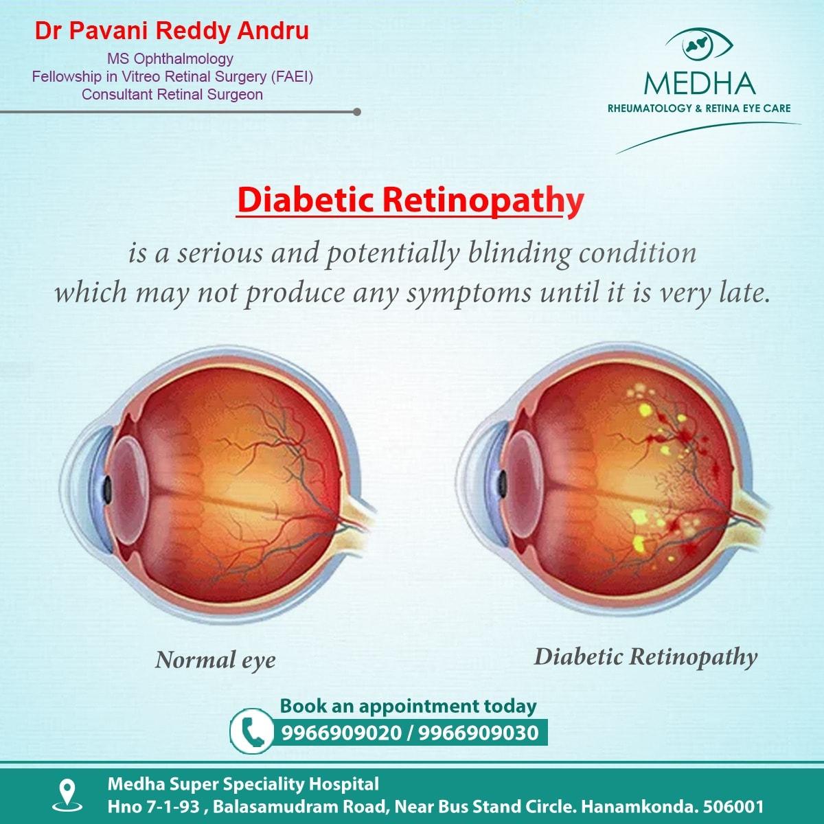 What is Diabetes retinopathy ?