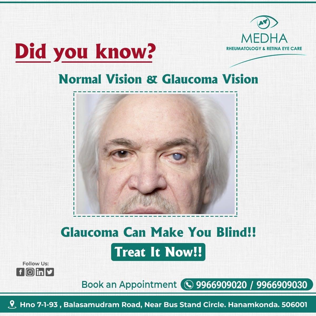 DYK about Normal Vision And Glaucoma Vision