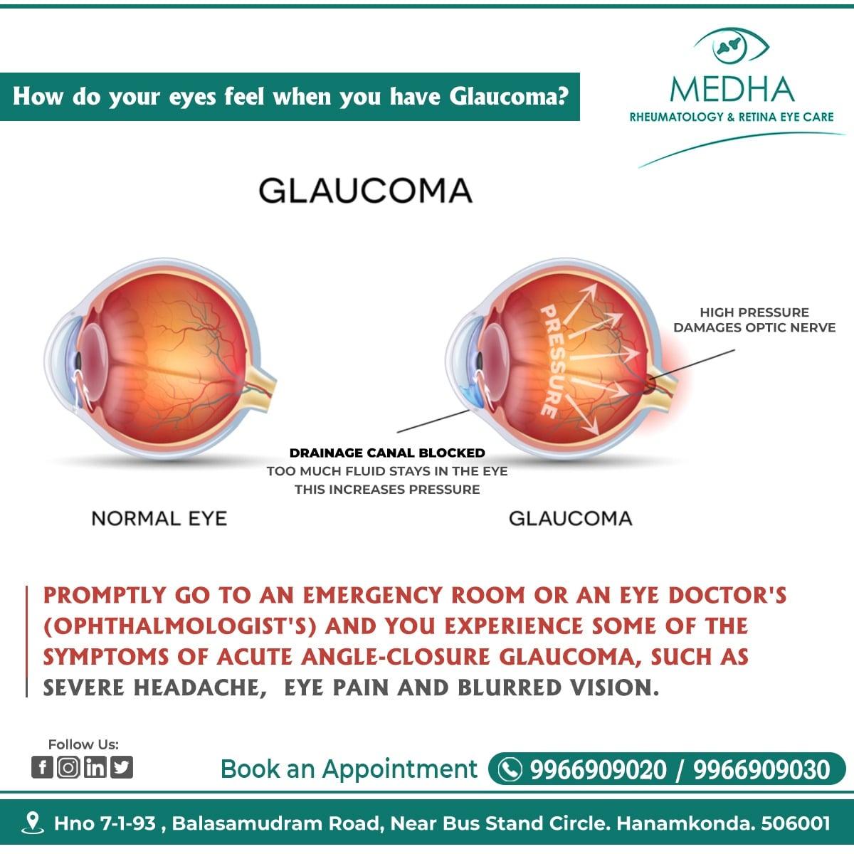 How do your eyes feel when you have GLAUCOMA ?