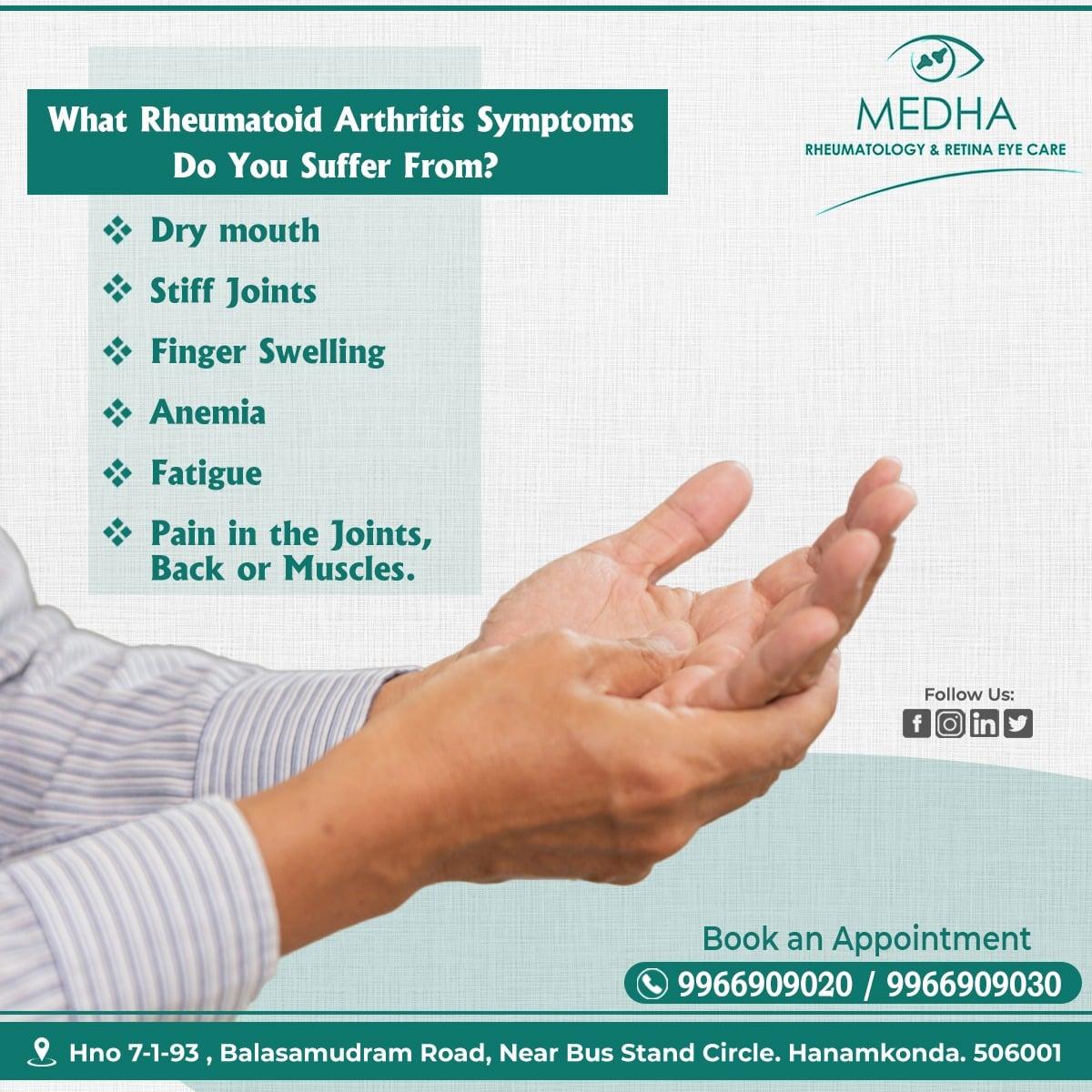 Signs and symptoms of Rheumatoid Arthritis