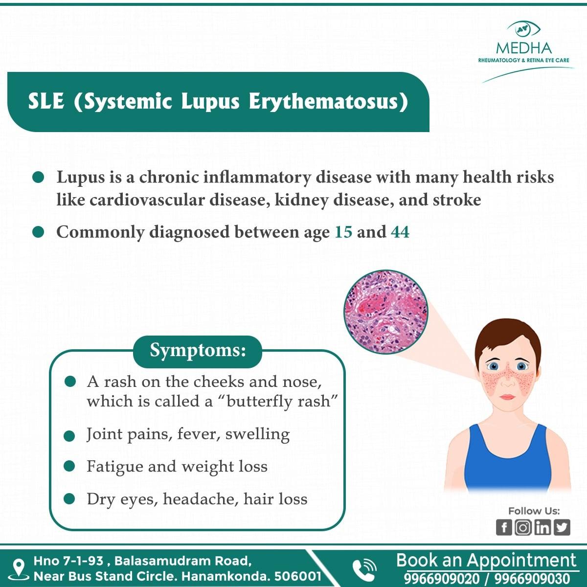 SLE (Systemic lupus erythematosus)