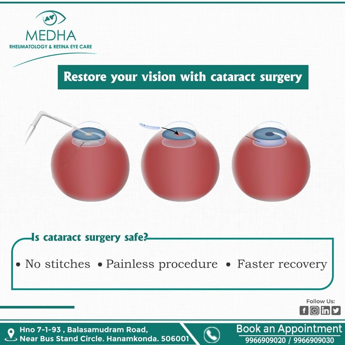 Restore Your Vision With Cataract Surgery ..