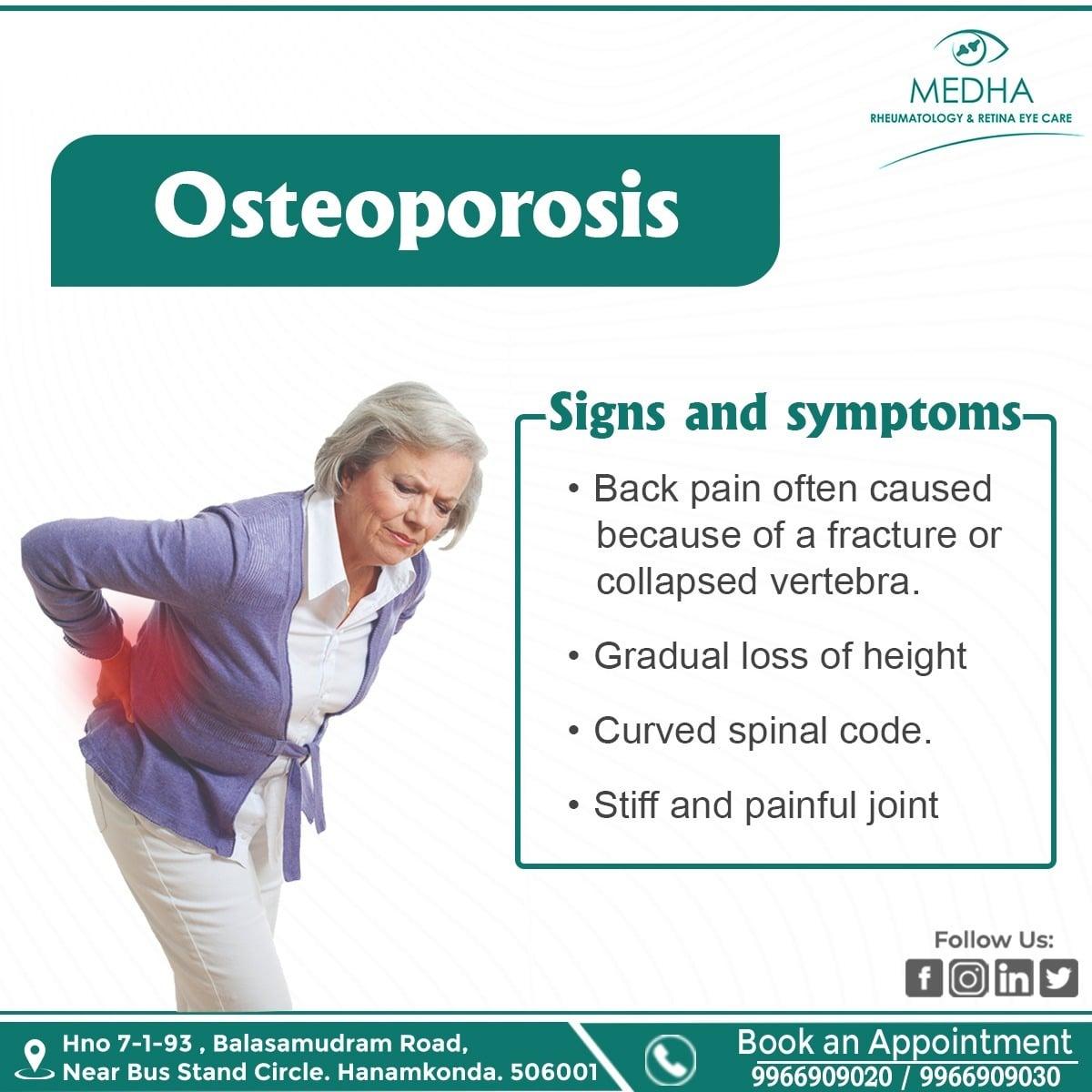 Osteoporosis Signs And Symptoms..