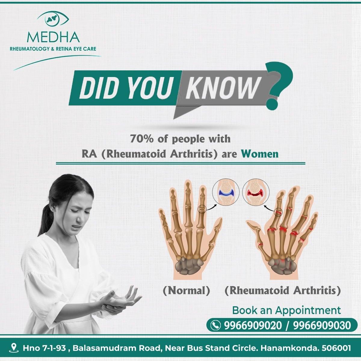 Rheumatoid Arthritis Facts !!!!!