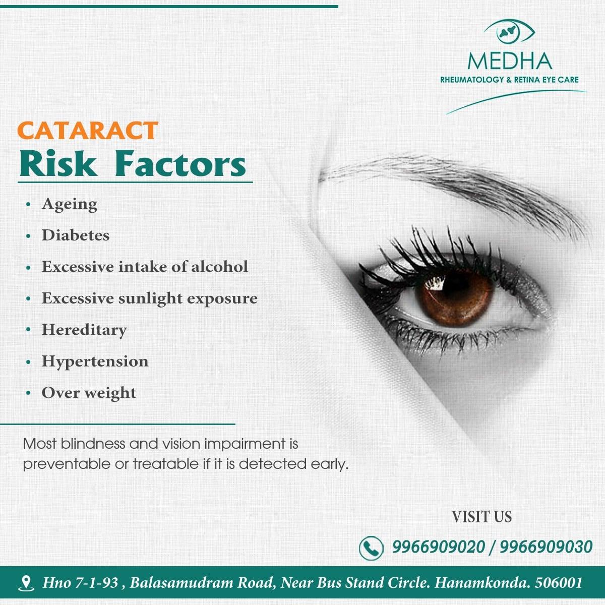 Cataract Risk Factors