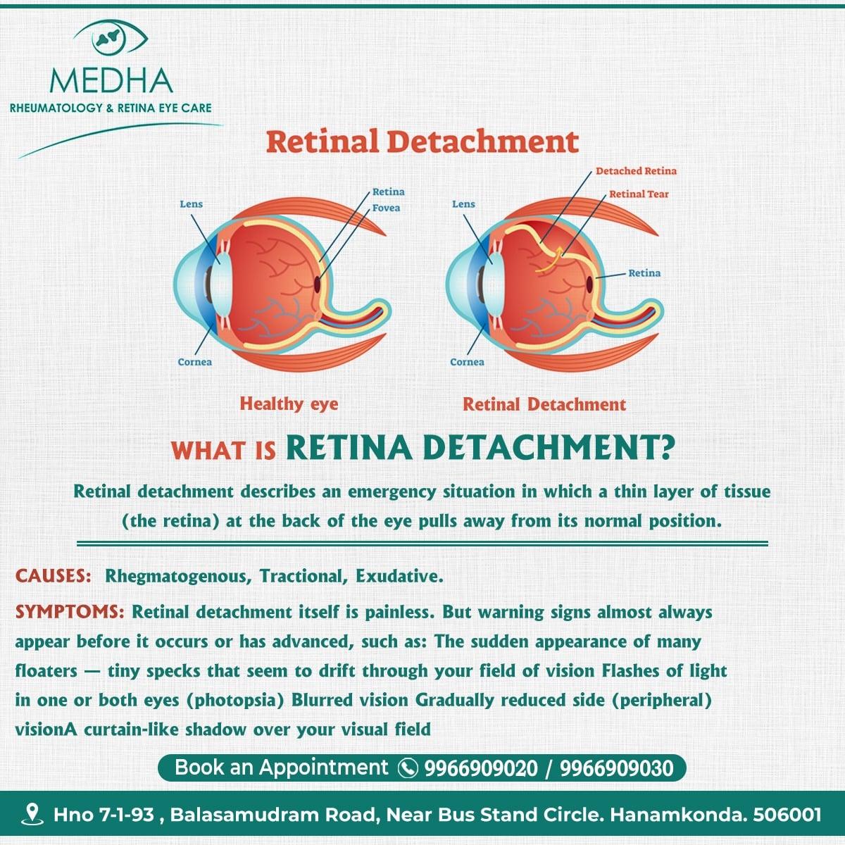 Common Retinal Diseases And Conditions....