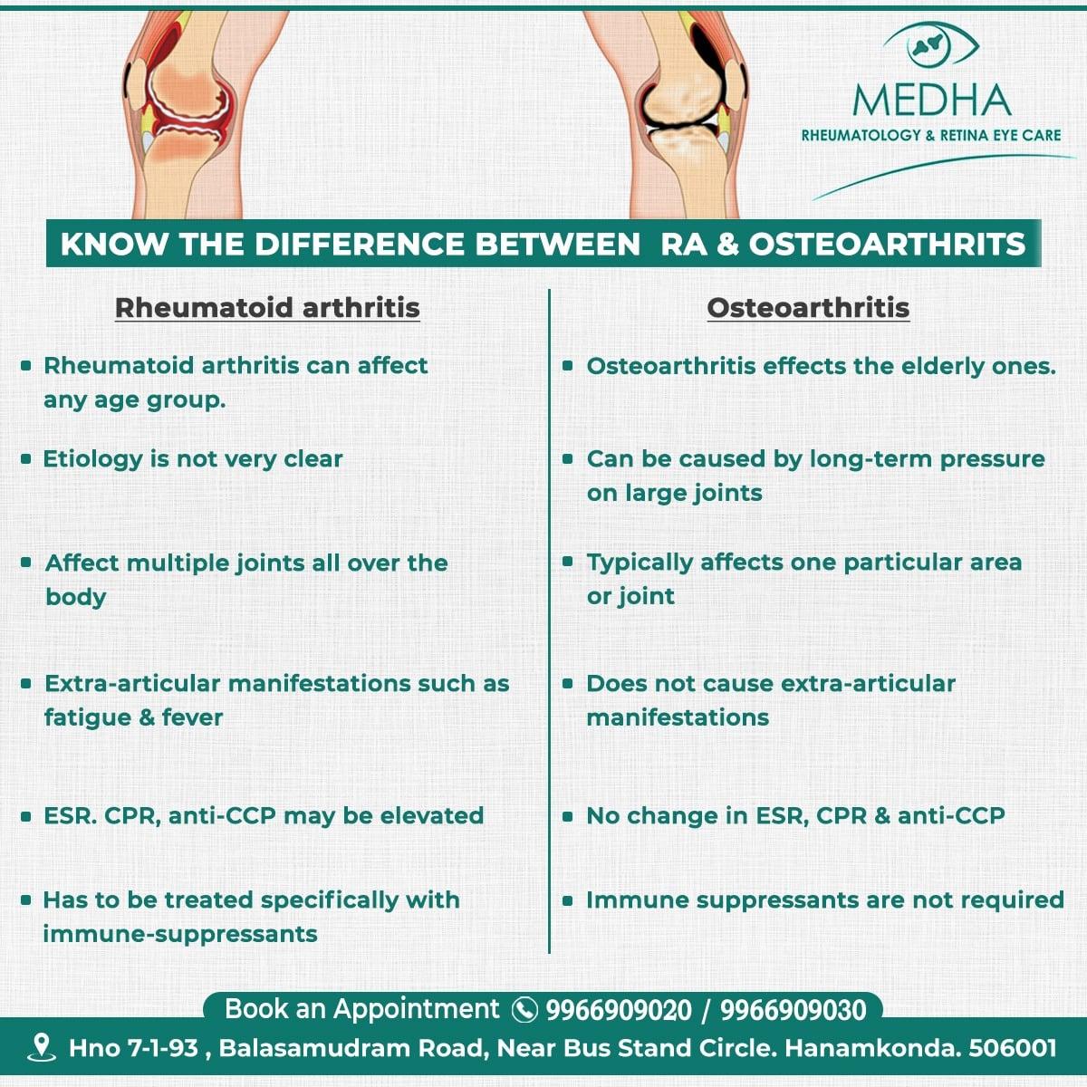 Difference Between RA And Osteoarthritis