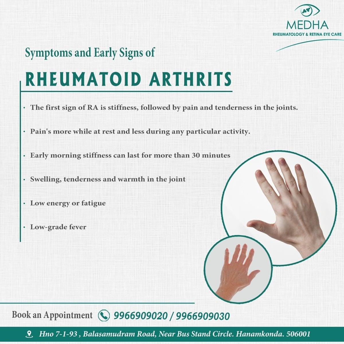 Symptoms And Early Signs Of Rheumatoid Arthritis