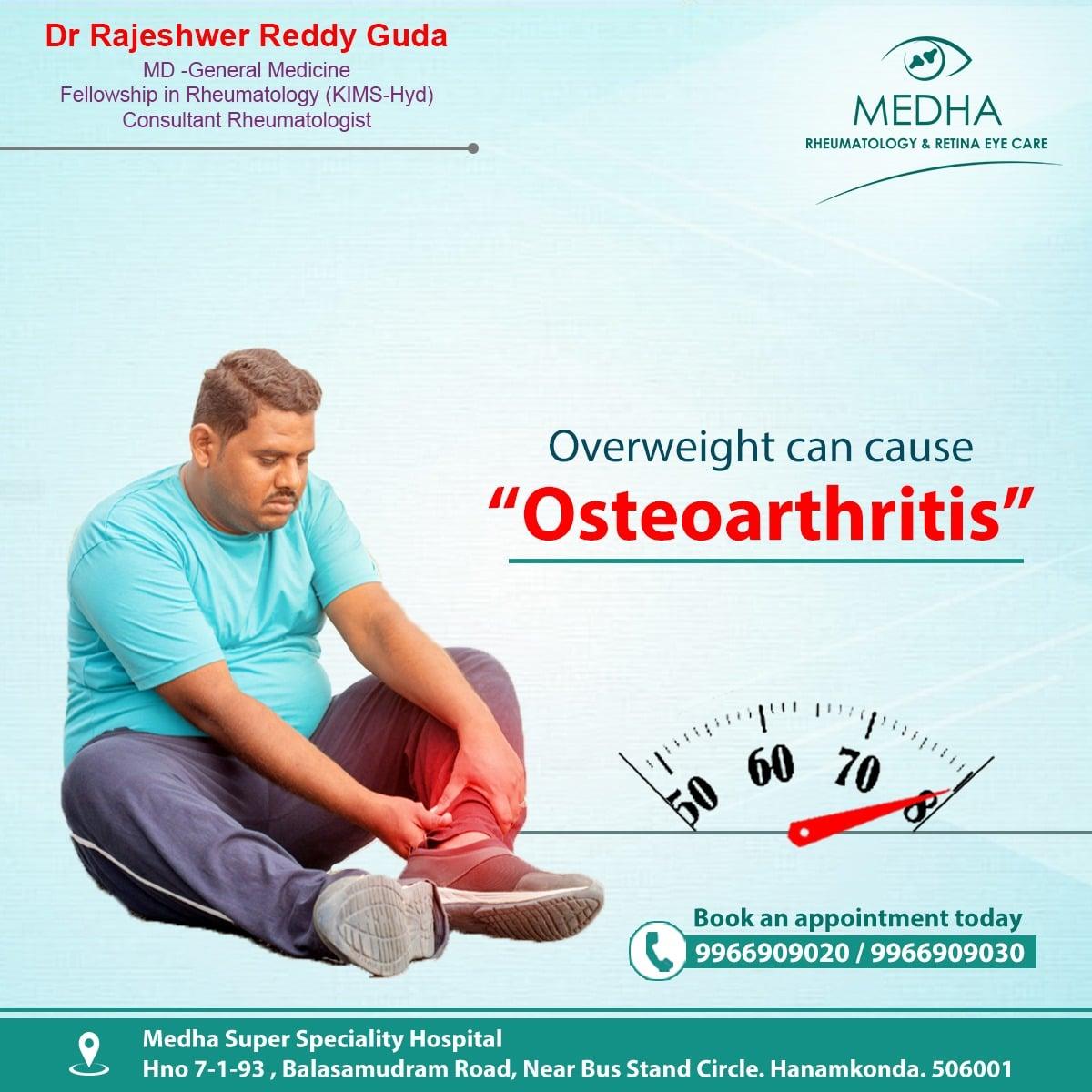 Overweight can cause "OSTEOARTHRITIS"