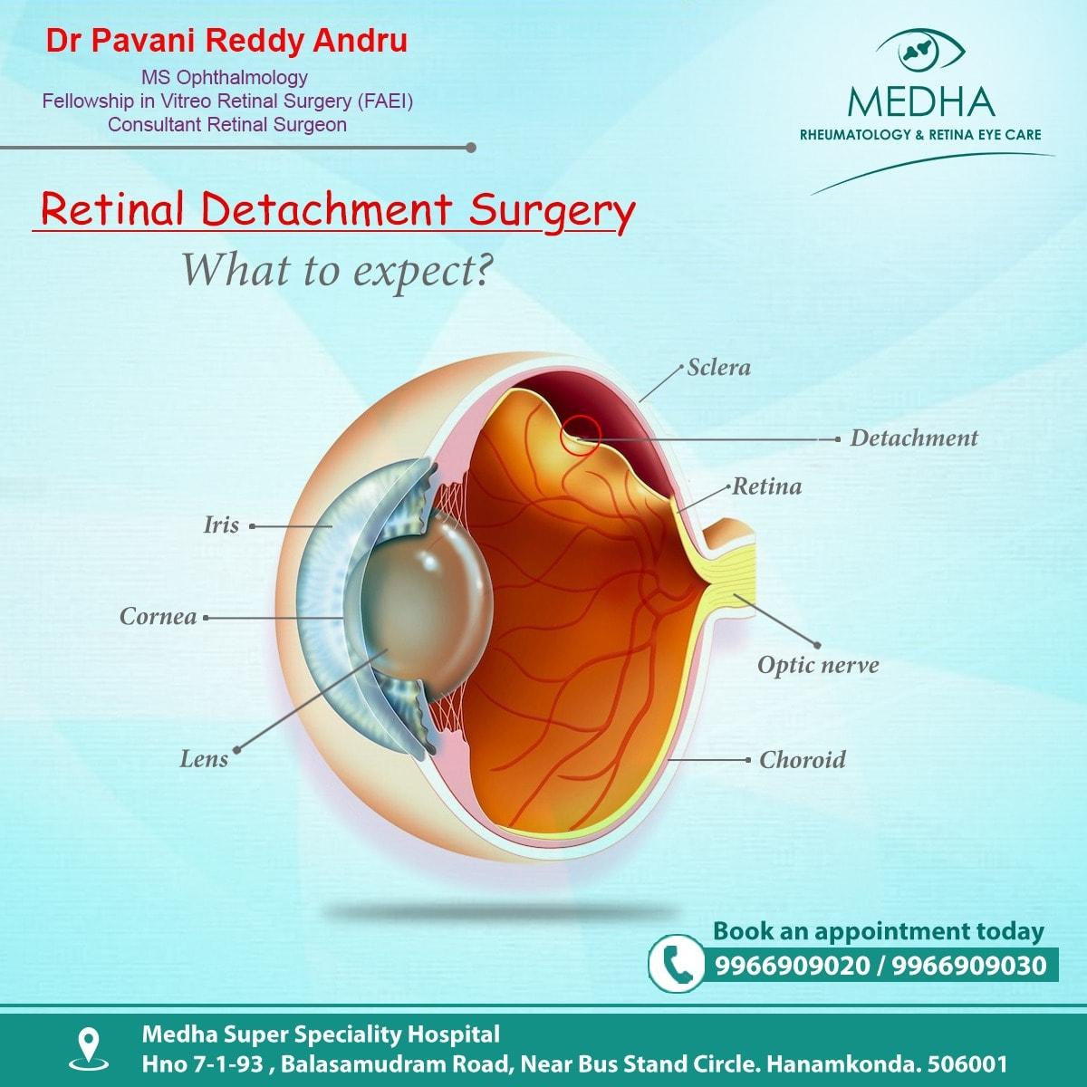 For Better Service, Better Result and Better Vision.. Visit Medha Retina Eye Care Center