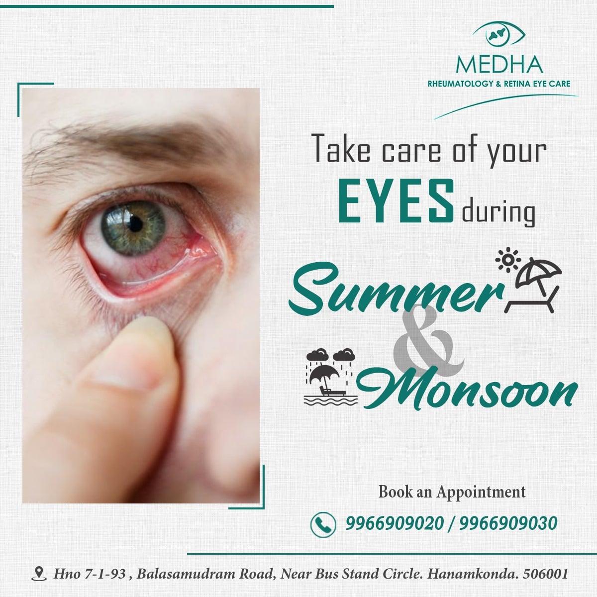 Take Care Of Your EYES During SUMMER & MONSOON